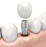 dental