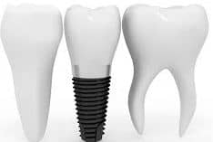 dental